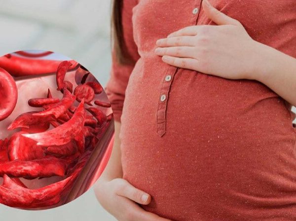 کمخونی در بارداری