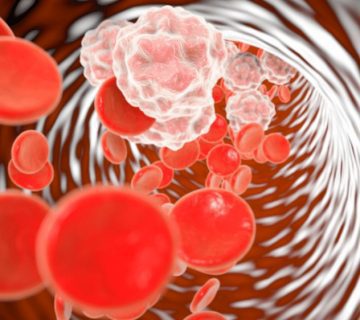 افزایش گردش خون