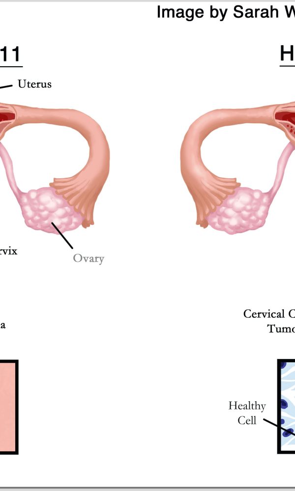 ویروس HPV چیست