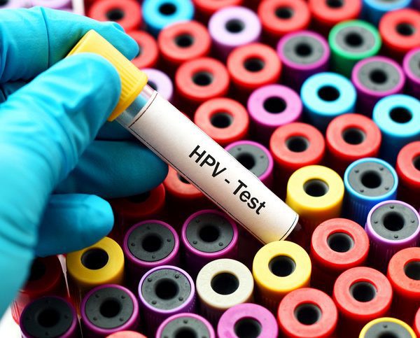 تست HPV