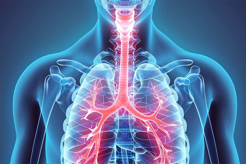 امبولی ریه در سالمندان امبولی ریه در سالمندان