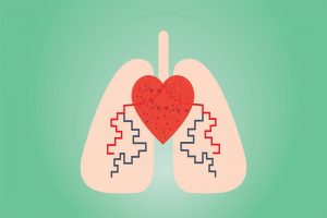 آمبولی ریه چه عوارضی دارد؟ آمبولی ریه چه عوارضی دارد؟