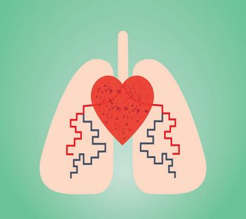 آمبولی ریه چه عوارضی دارد؟