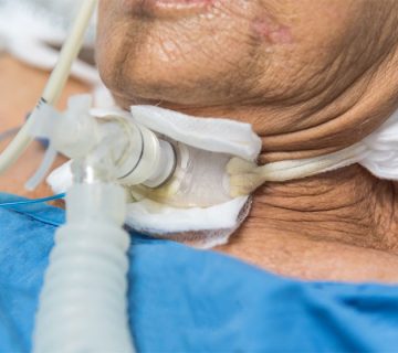 مراقبت از تراکئوستومی در خانه