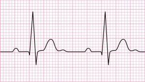 ضربان قلب