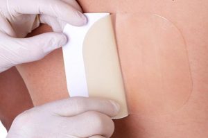 پانسمان زخم بستر در منزل پانسمان زخم بستر در منزل - طلوع طب