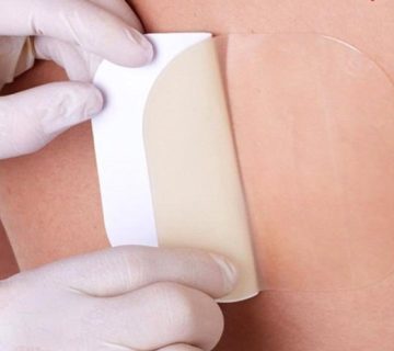 پانسمان زخم بستر در منزل - طلوع طب