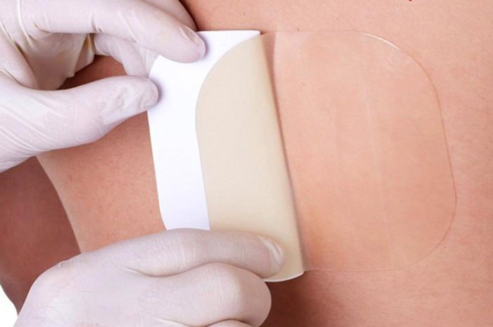 پانسمان زخم بستر در منزل پانسمان زخم بستر در منزل - طلوع طب