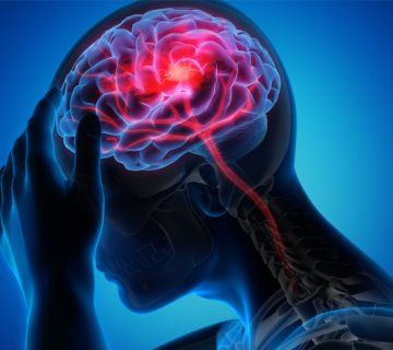 سکته مغزی (CVA) در سالمندان