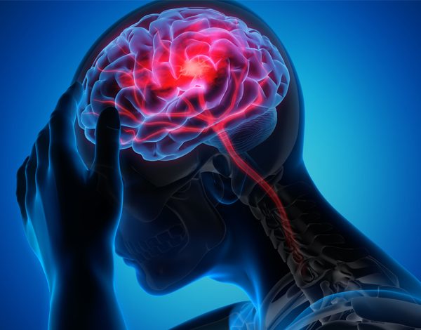 سکته مغزی (CVA) در سالمندان