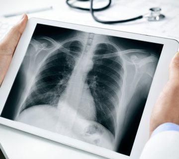 رادیولوژی در منزل- طلوع طب