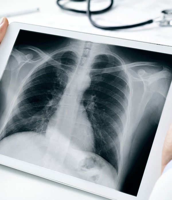 رادیولوژی در منزل- طلوع طب