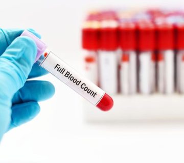 لیست آزمایش خون کامل