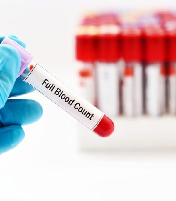 لیست آزمایش خون کامل