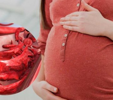 کم‌خونی در بارداری