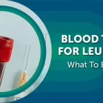 اولین نشانه سرطان در آزمایش خون