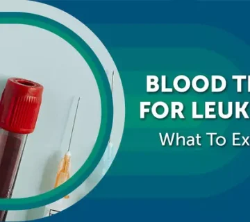 اولین نشانه سرطان در آزمایش خون