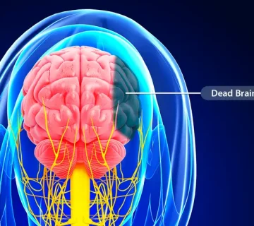 علائم سکته مغزی خاموش چیست
