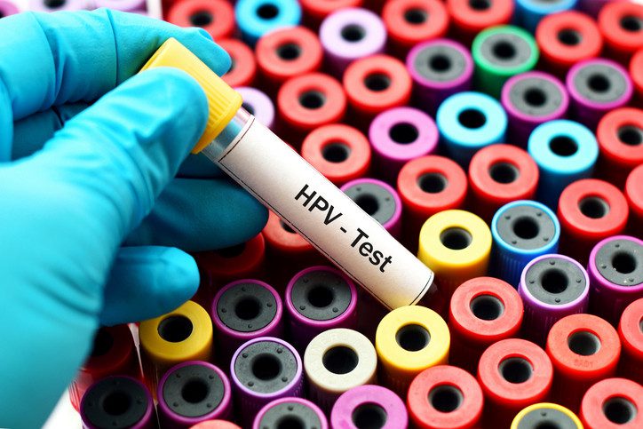 تست HPV
