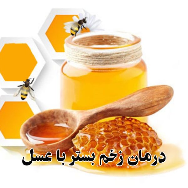درمان زخم بستر با عسل