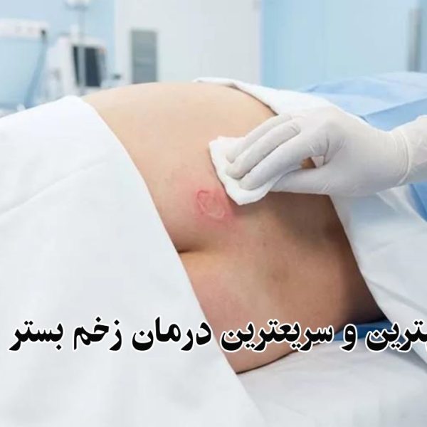 سریع ترین درمان زخم بستر