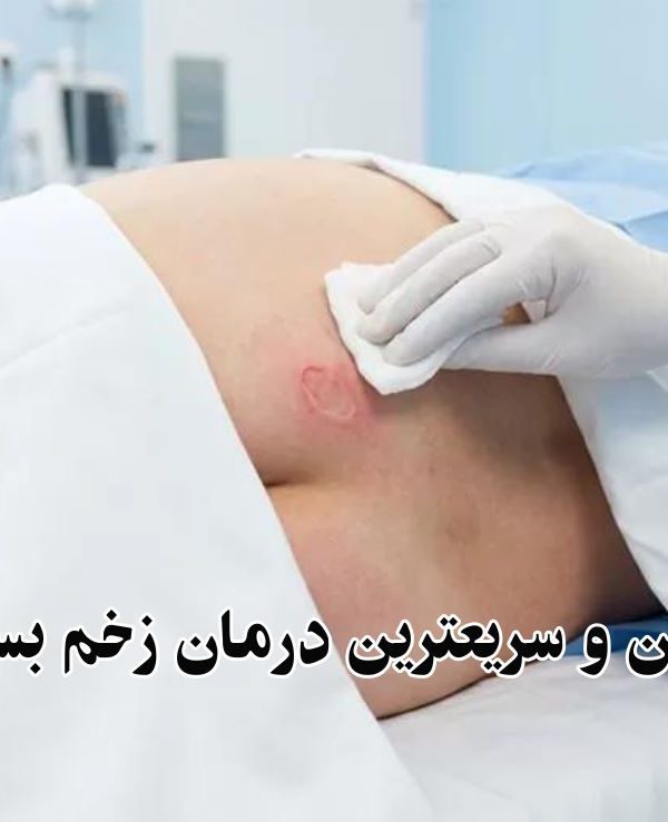 سریع‌ ترین درمان زخم بستر