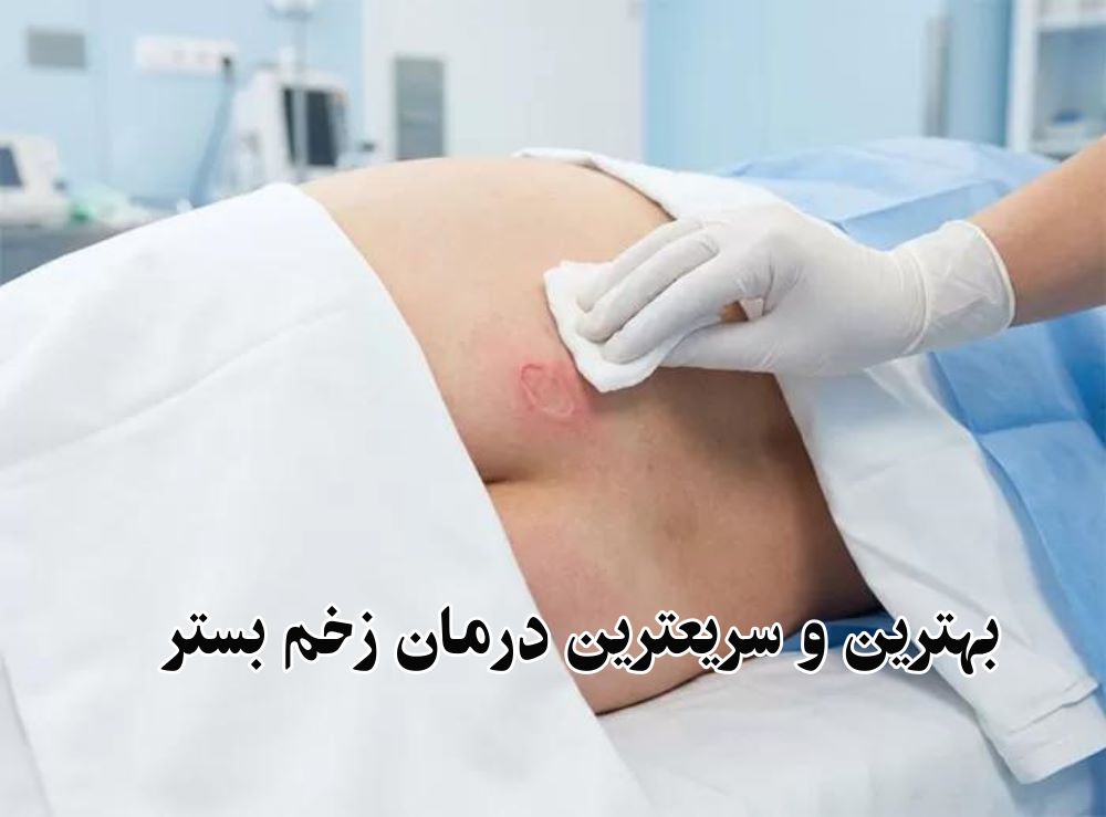 سریع ترین درمان زخم بستر
